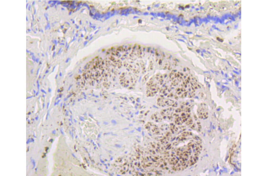 Immunohistochemistry - Anti-HK1 Antibody (A10886) - Antibodies.com