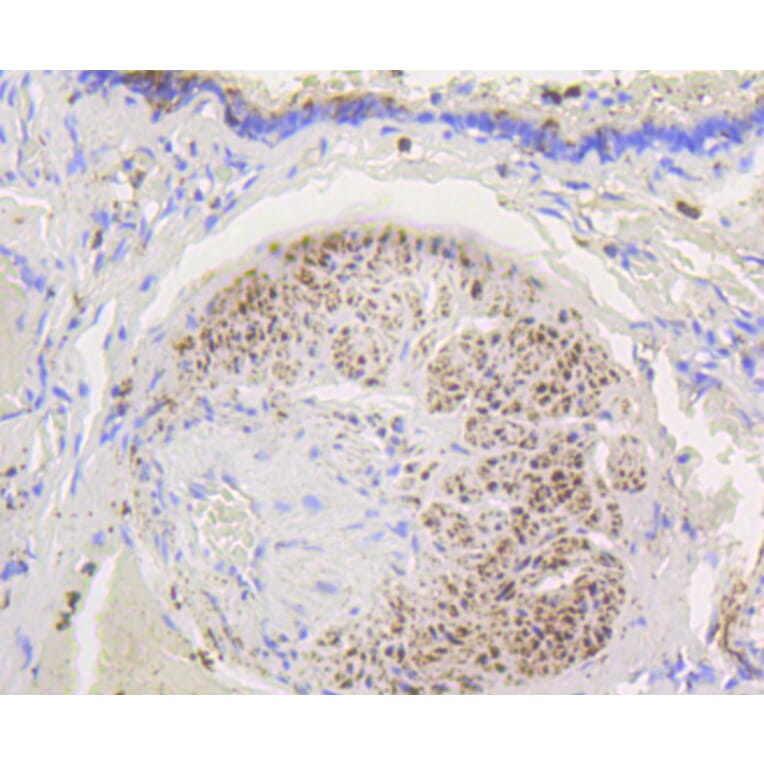 Immunohistochemistry - Anti-HK1 Antibody (A10886) - Antibodies.com