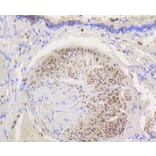 Immunohistochemistry - Anti-HK1 Antibody (A10886) - Antibodies.com