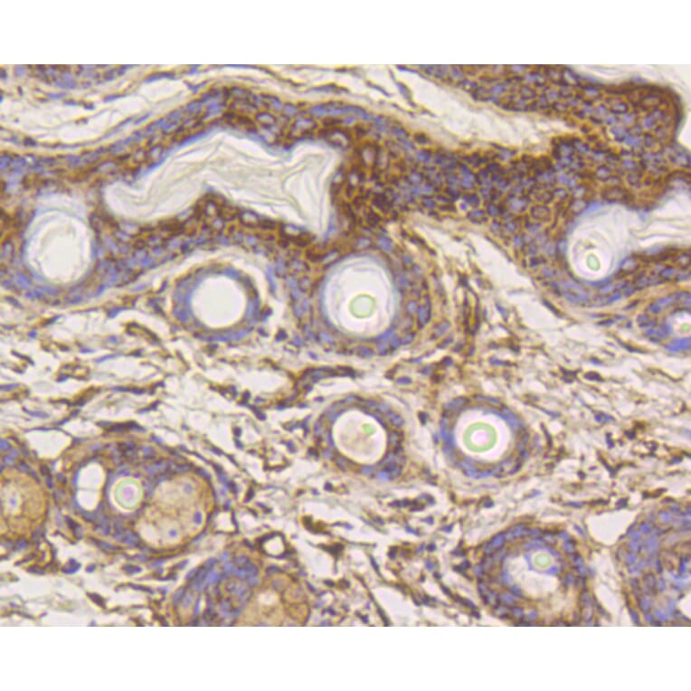 Immunohistochemistry - Anti-HK1 Antibody (A10886) - Antibodies.com