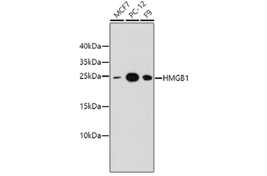 Western Blot - Anti-HMGB1 Antibody (A10889) - Antibodies.com