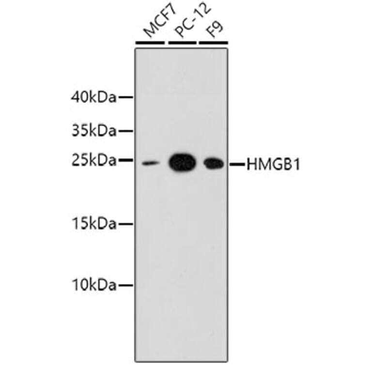 Western Blot - Anti-HMGB1 Antibody (A10889) - Antibodies.com