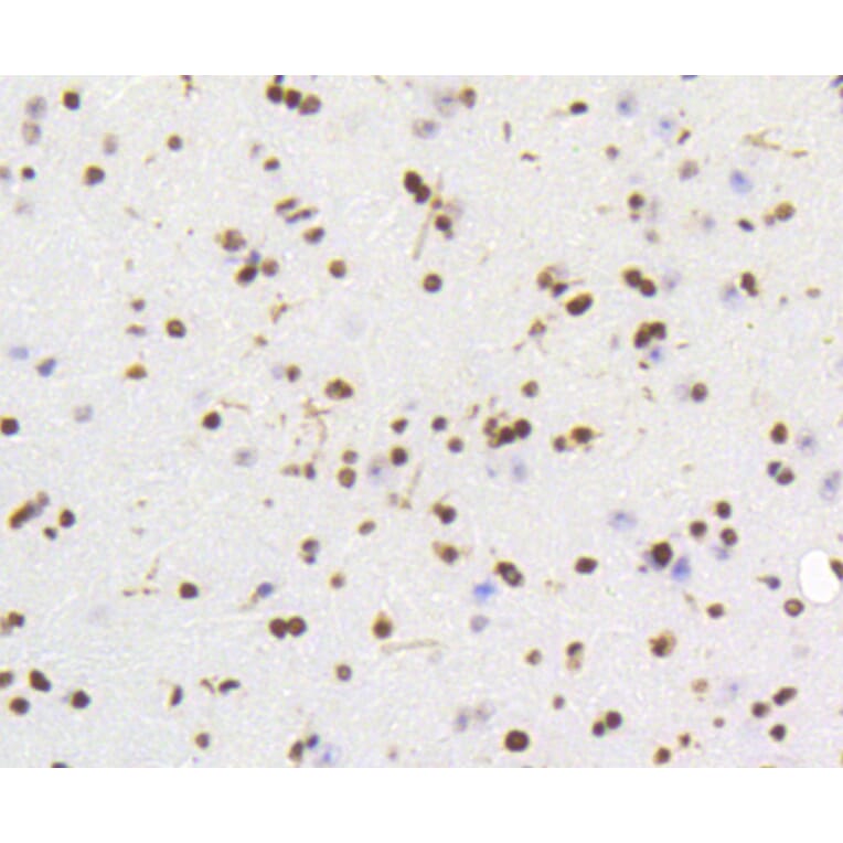 Immunohistochemistry - Anti-HMGB1 Antibody (A10889) - Antibodies.com