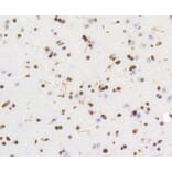 Immunohistochemistry - Anti-HMGB1 Antibody (A10889) - Antibodies.com