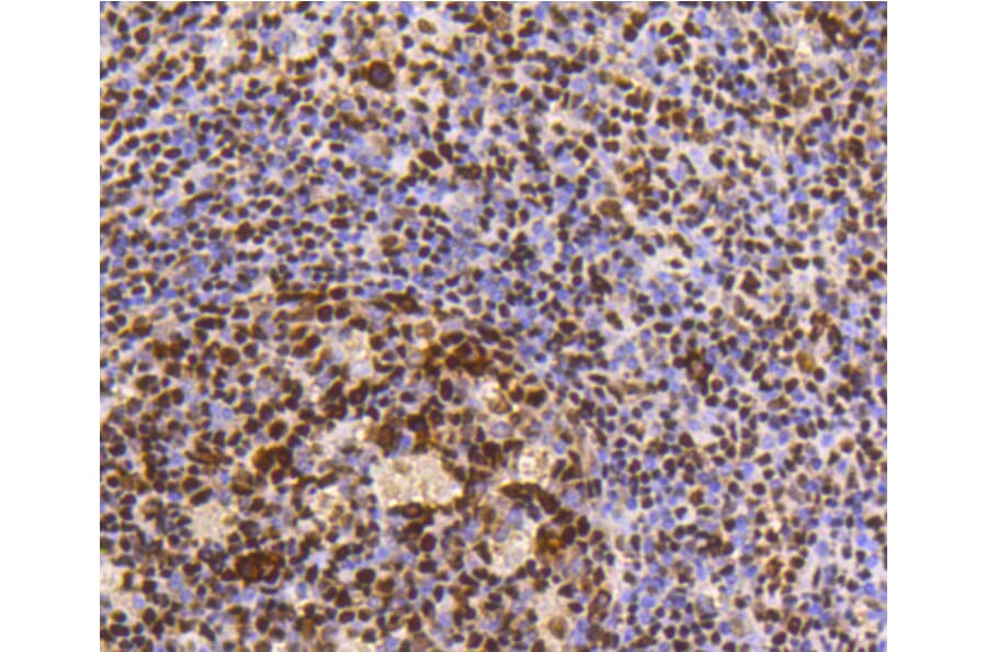 Immunohistochemistry - Anti-HMGB1 Antibody (A10889) - Antibodies.com