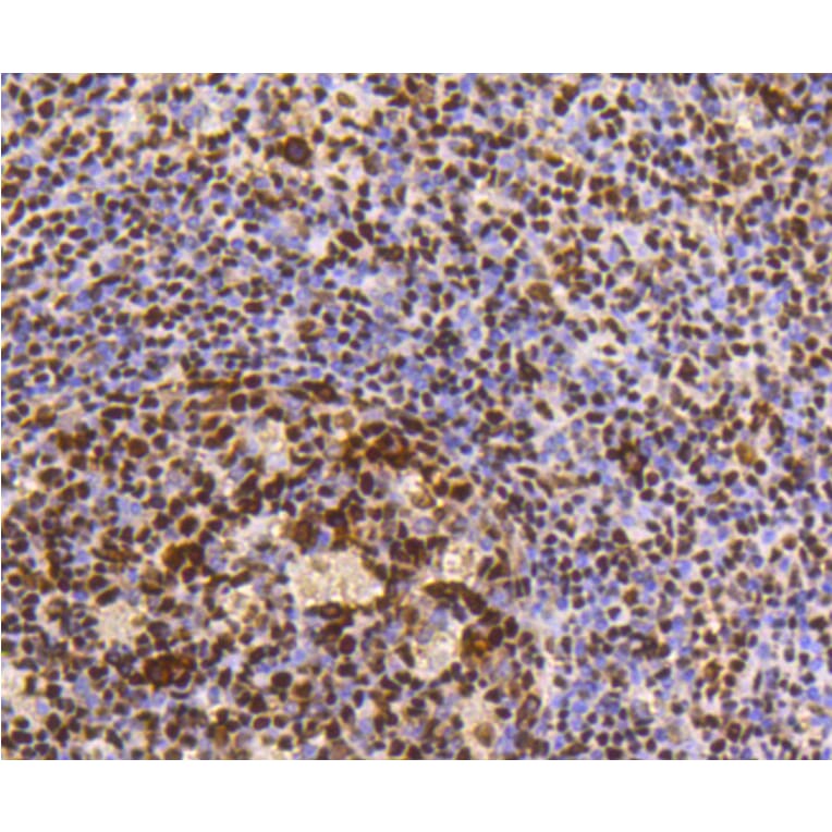 Immunohistochemistry - Anti-HMGB1 Antibody (A10889) - Antibodies.com