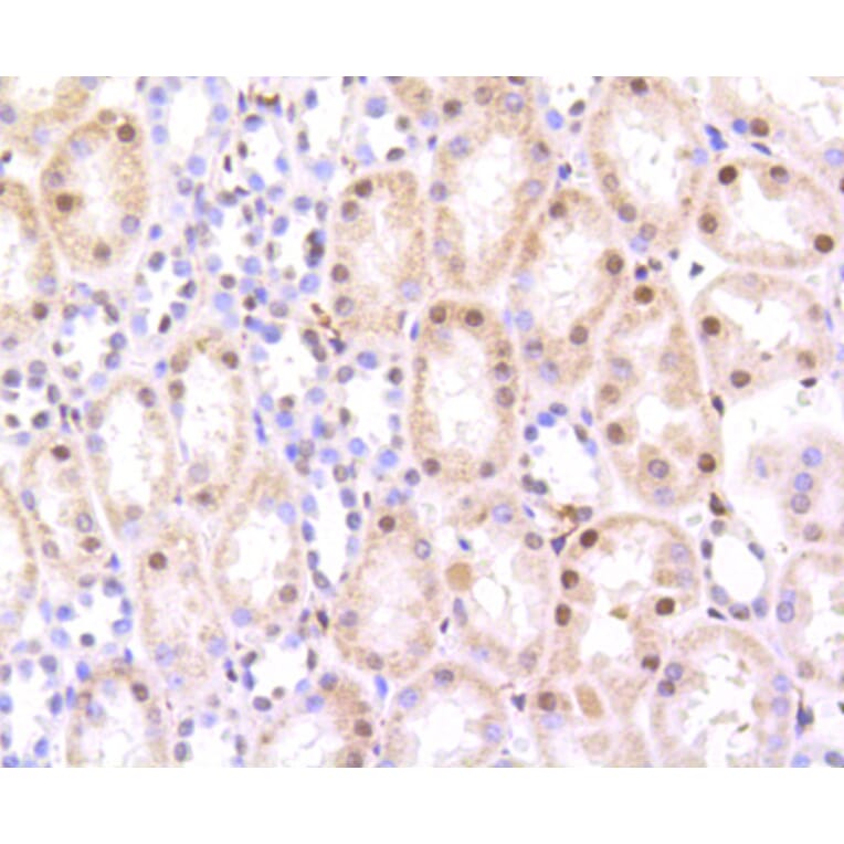 Immunohistochemistry - Anti-HMGB1 Antibody (A10889) - Antibodies.com