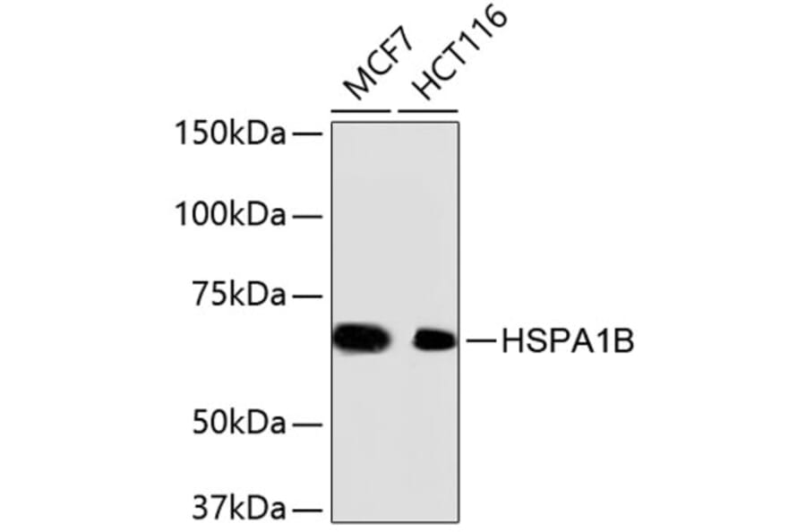 Western Blot - Anti-Hsp70 Antibody (A10897) - Antibodies.com