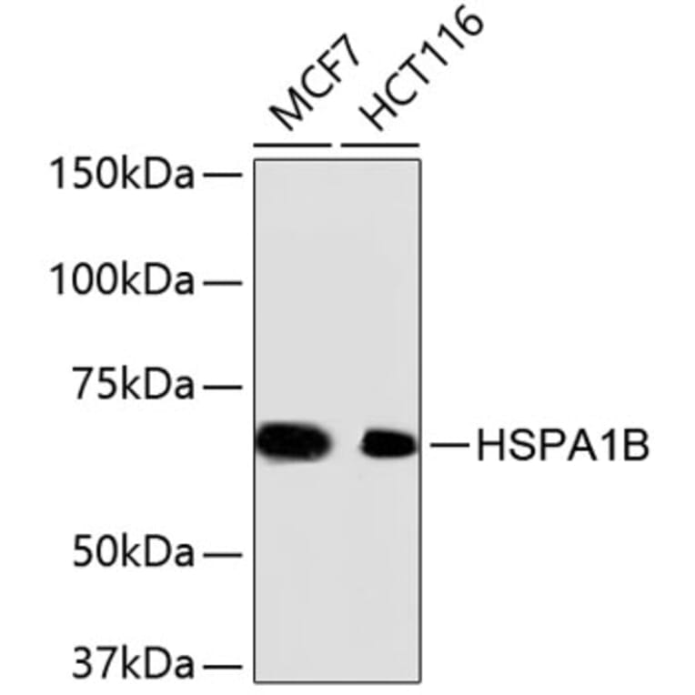 Western Blot - Anti-Hsp70 Antibody (A10897) - Antibodies.com
