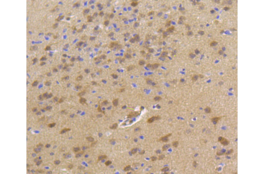 Immunohistochemistry - Anti-Hsp70 Antibody (A10897) - Antibodies.com