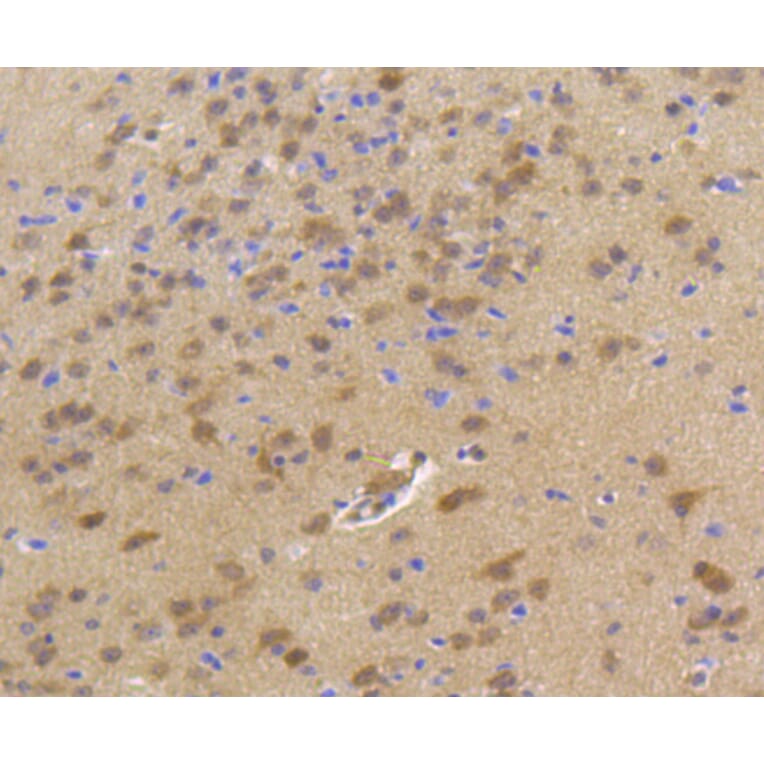 Immunohistochemistry - Anti-Hsp70 Antibody (A10897) - Antibodies.com