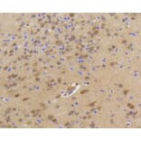 Immunohistochemistry - Anti-Hsp70 Antibody (A10897) - Antibodies.com