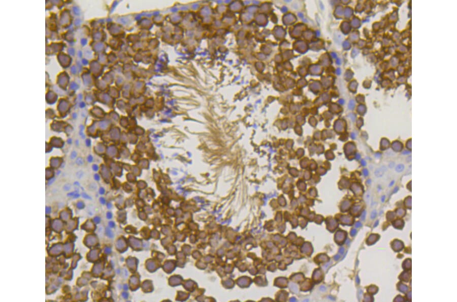 Immunohistochemistry - Anti-Hsp70 Antibody (A10897) - Antibodies.com