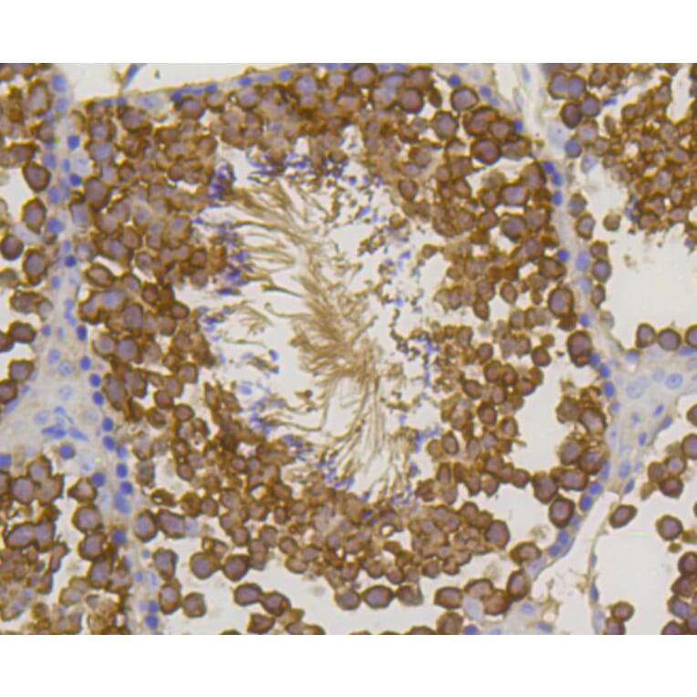 Immunohistochemistry - Anti-Hsp70 Antibody (A10897) - Antibodies.com