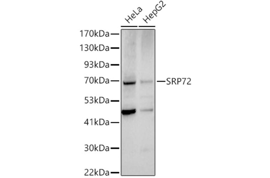 Western Blot - Anti-SRP72 Antibody (A13127) - Antibodies.com