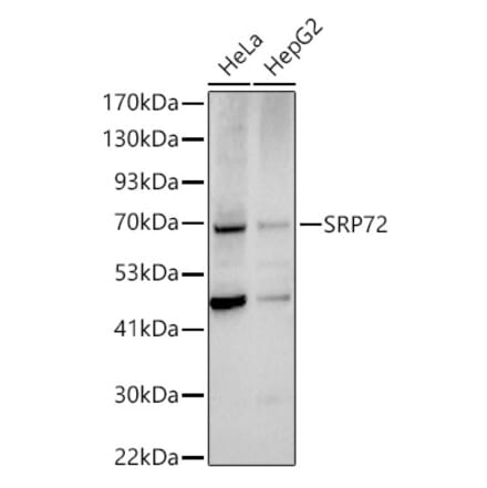 Western Blot - Anti-SRP72 Antibody (A13127) - Antibodies.com