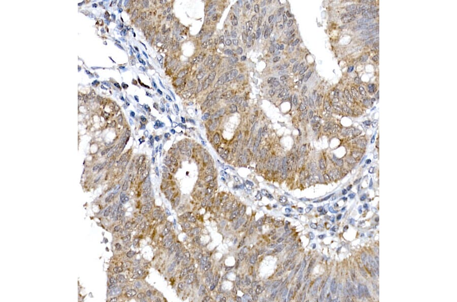 Immunohistochemistry - Anti-SRP72 Antibody (A13127) - Antibodies.com
