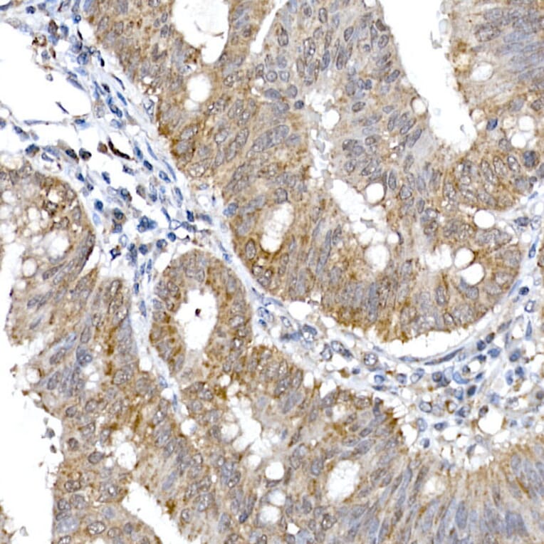Immunohistochemistry - Anti-SRP72 Antibody (A13127) - Antibodies.com