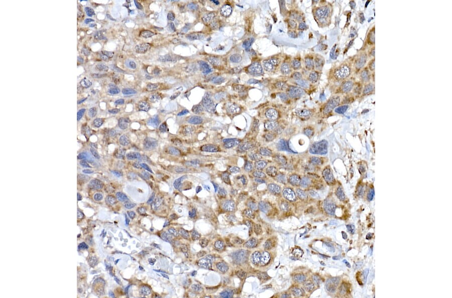 Immunohistochemistry - Anti-SRP72 Antibody (A13127) - Antibodies.com