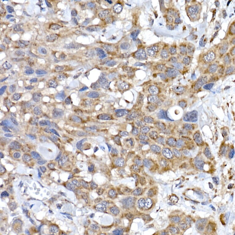 Immunohistochemistry - Anti-SRP72 Antibody (A13127) - Antibodies.com