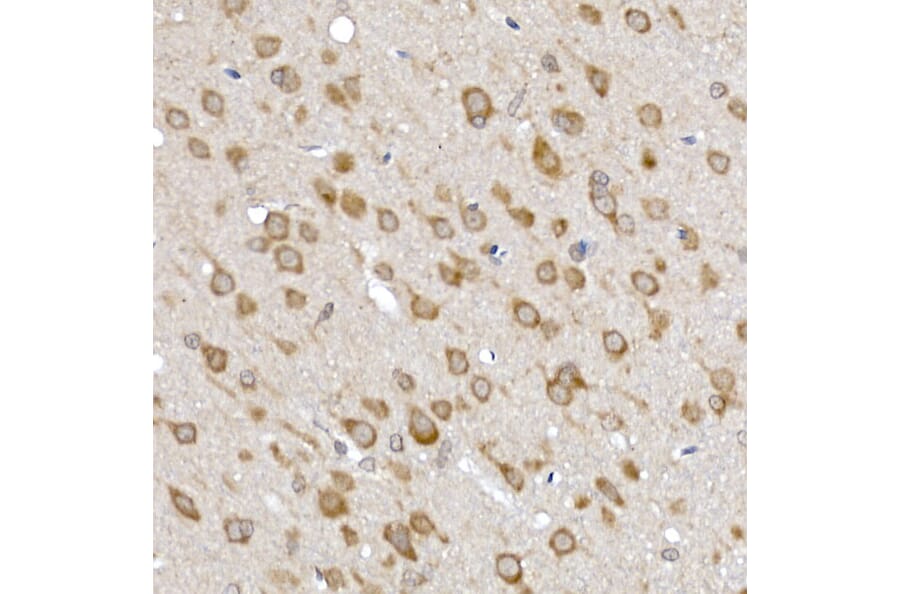 Immunohistochemistry - Anti-SRP72 Antibody (A13127) - Antibodies.com
