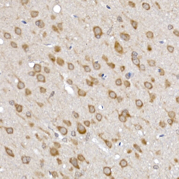 Immunohistochemistry - Anti-SRP72 Antibody (A13127) - Antibodies.com