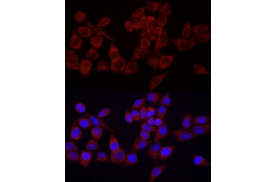 Immunofluorescence - Anti-SRP72 Antibody (A13127) - Antibodies.com