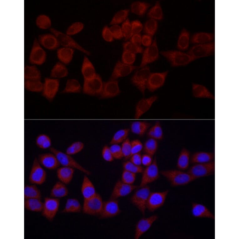 Immunofluorescence - Anti-SRP72 Antibody (A13127) - Antibodies.com