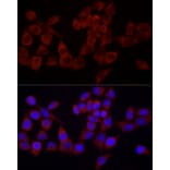 Immunofluorescence - Anti-SRP72 Antibody (A13127) - Antibodies.com