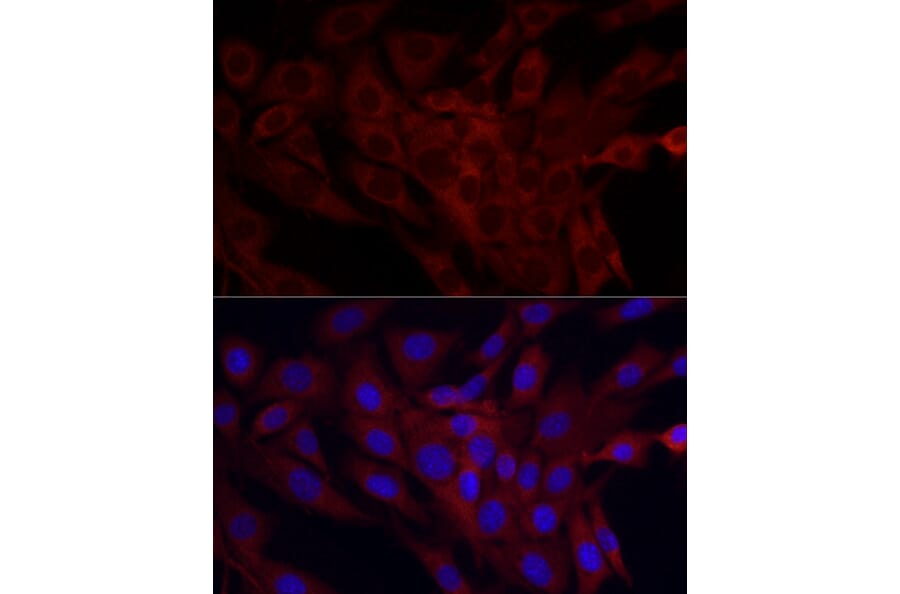 Immunofluorescence - Anti-SRP72 Antibody (A13127) - Antibodies.com