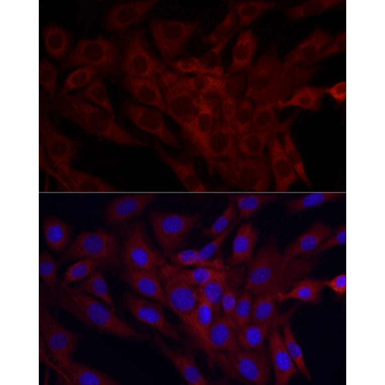 Immunofluorescence - Anti-SRP72 Antibody (A13127) - Antibodies.com
