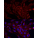 Immunofluorescence - Anti-SRP72 Antibody (A13127) - Antibodies.com
