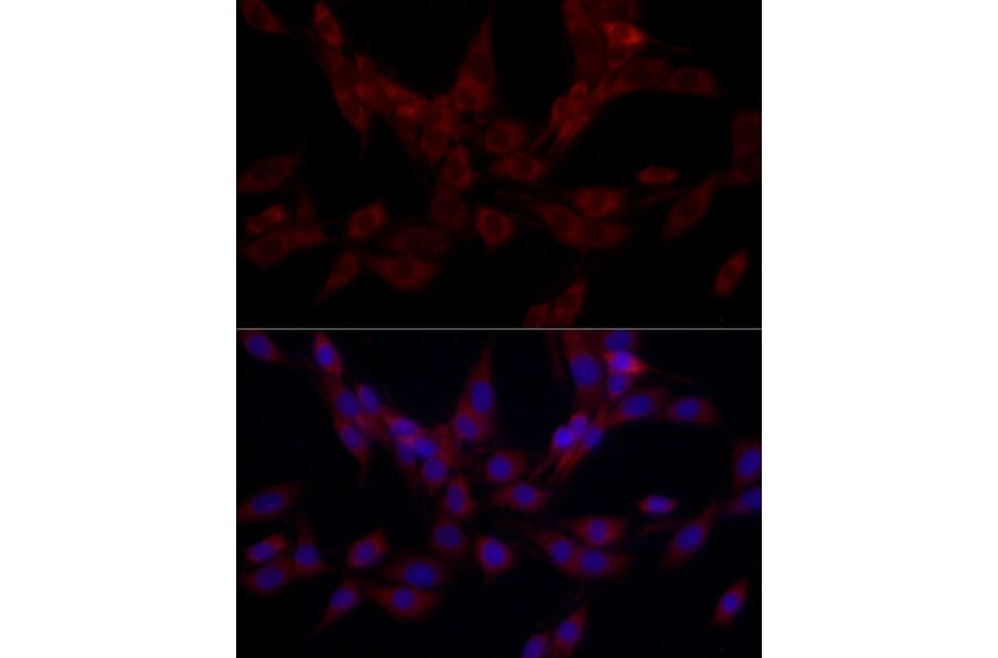 Immunofluorescence - Anti-SRP72 Antibody (A13127) - Antibodies.com