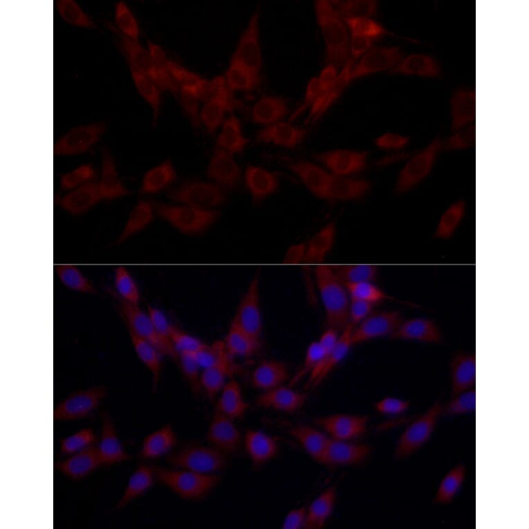 Immunofluorescence - Anti-SRP72 Antibody (A13127) - Antibodies.com