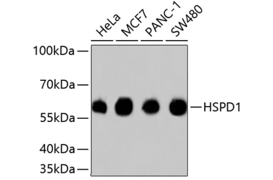 Western Blot - Anti-HSPD1 Antibody (A10906) - Antibodies.com