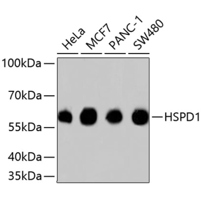 Western Blot - Anti-HSPD1 Antibody (A10906) - Antibodies.com