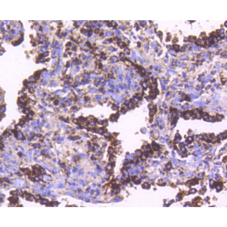 Immunohistochemistry - Anti-HSPD1 Antibody (A10906) - Antibodies.com