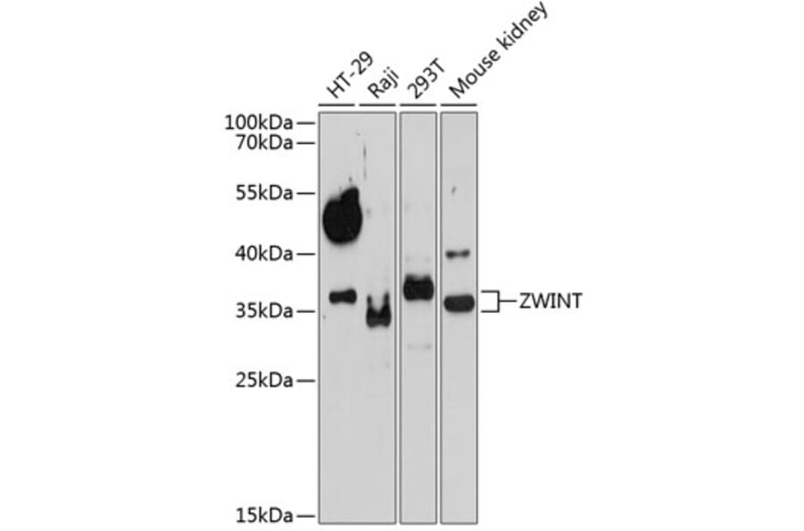 Western Blot - Anti-ZWINT Antibody (A10914) - Antibodies.com
