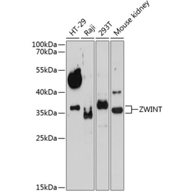 Western Blot - Anti-ZWINT Antibody (A10914) - Antibodies.com