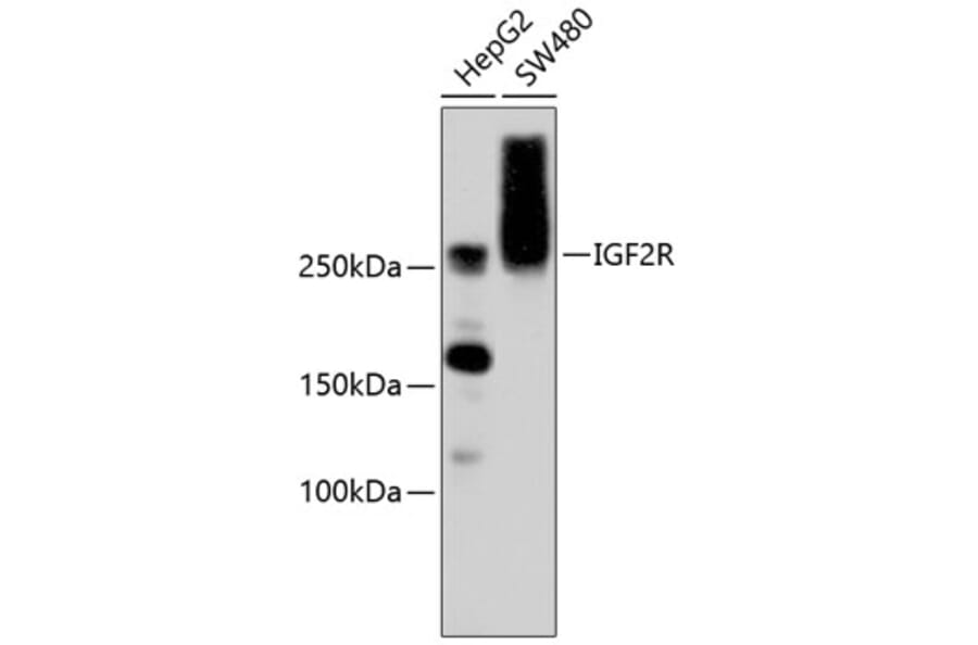 Western Blot - Anti-IGF2R Antibody (A10916) - Antibodies.com