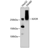 Western Blot - Anti-IGF2R Antibody (A10916) - Antibodies.com