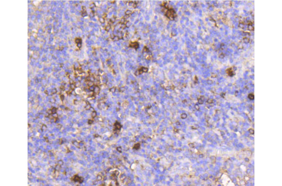 Immunohistochemistry - Anti-IGF2R Antibody (A10916) - Antibodies.com