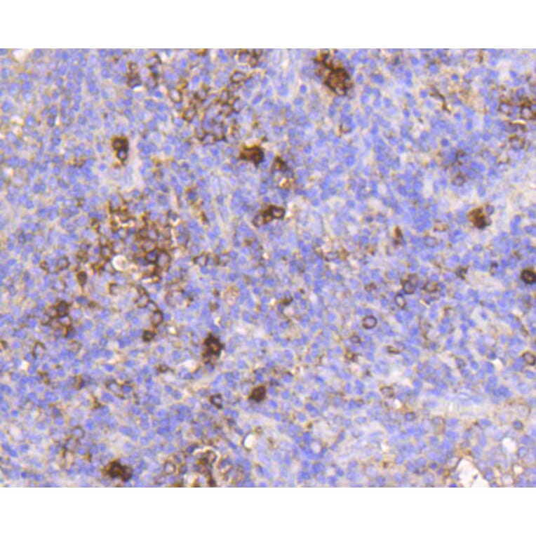 Immunohistochemistry - Anti-IGF2R Antibody (A10916) - Antibodies.com