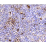 Immunohistochemistry - Anti-IGF2R Antibody (A10916) - Antibodies.com