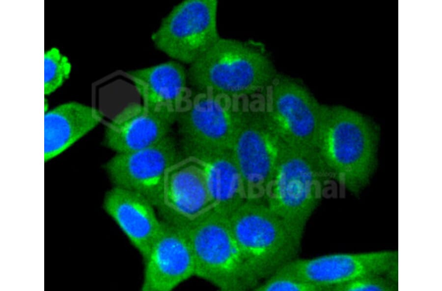Immunofluorescence - Anti-IGF2R Antibody (A10916) - Antibodies.com