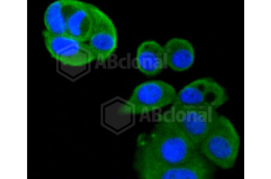 Immunofluorescence - Anti-IGF2R Antibody (A10916) - Antibodies.com
