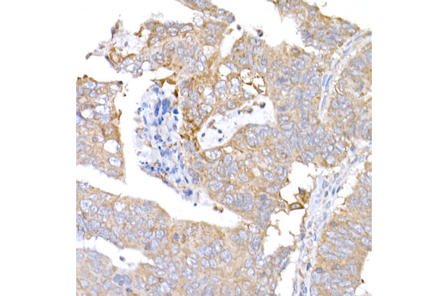 Immunohistochemistry - Anti-MAGED1/NRAGE Antibody (A13138) - Antibodies.com