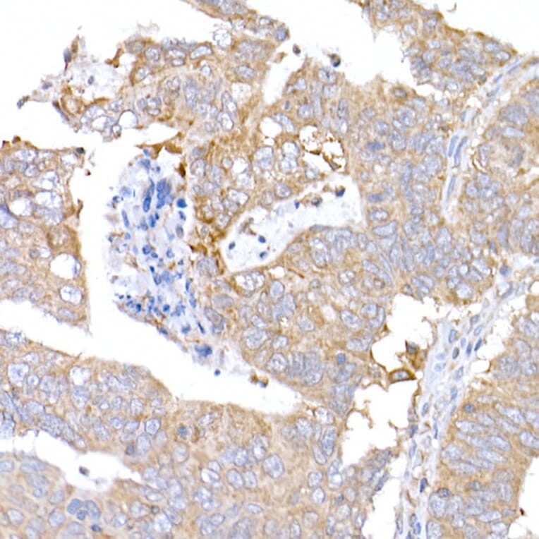 Immunohistochemistry - Anti-MAGED1/NRAGE Antibody (A13138) - Antibodies.com