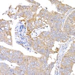 Immunohistochemistry - Anti-MAGED1/NRAGE Antibody (A13138) - Antibodies.com