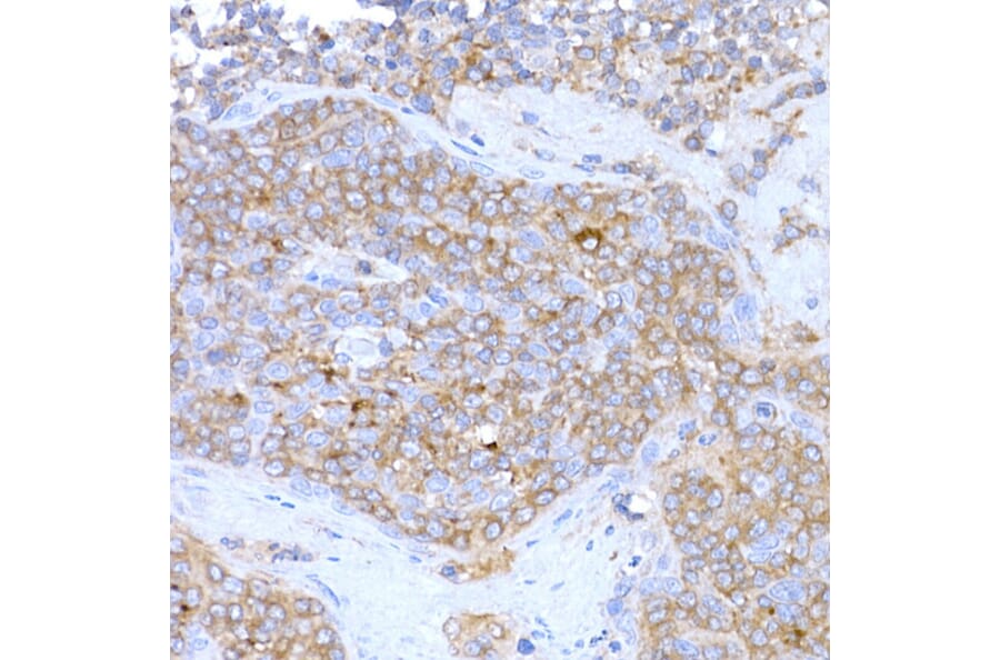 Immunohistochemistry - Anti-MAGED1/NRAGE Antibody (A13138) - Antibodies.com